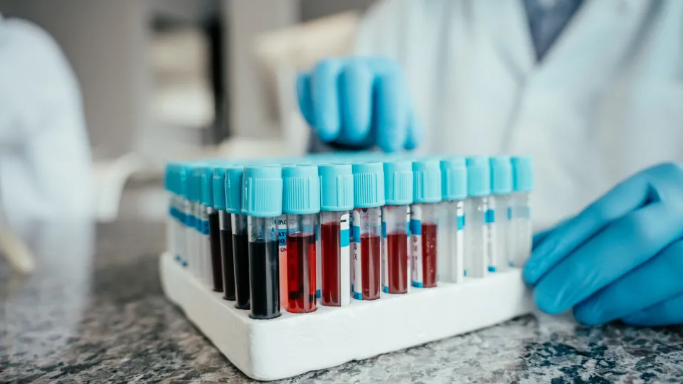Test tubes with p-tau217 blood tests